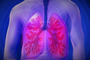 L'asthme, une des conséquences directe de la pollution